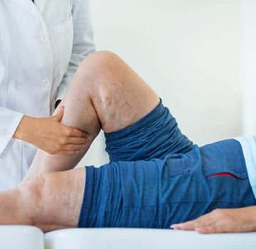 Clinical vein consultation at Cosmetic & Vein Center of Oklahoma, Tulsa.